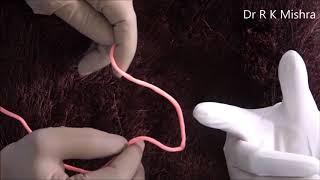 Laparoscopic Extracorporeal Square Knot demonstration by Dr R K Mishra