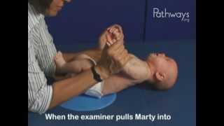 2 Month Old Baby Typical and Atypical Development