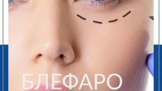 Блефаропластика.  "РЖД-Медицина" г. Тверь