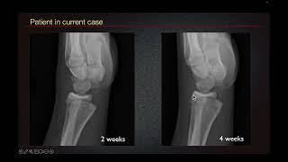 Sports Medicine Case 42: 14-year-old male: The Nuts and Bolts of Sports Medicine