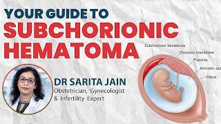 Your Guide To Subchorionic Hematoma  | Dr Sarita Jain | Arihant IVF