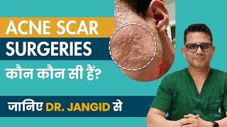 Types of Acne Scar Surgery Treatments and How Do They Work? Dr. Jangid | SkinQure