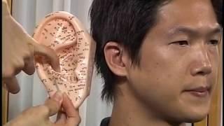 Auricular Acupuncture - Traditional Chinese Medicine and Acupuncture