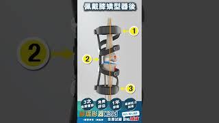 動態診斷及動態矯形O型膝痛 #kneepainexercises #牽引  #物理治療 #O型腳