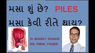 Piles Information in Gujarati- મસા વિષે ગુજરાતીમાં માહિતી #મસા #piles #pilestreatmentathome