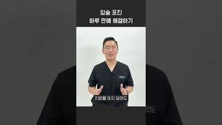 입술 헤르페스 하루만에 낫는 법 #shorts