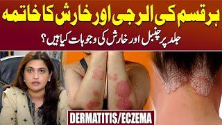 Chambal Ka llaj - Dermatitis (Eczema) Causes and Treatment | Dr. Salma Naeem