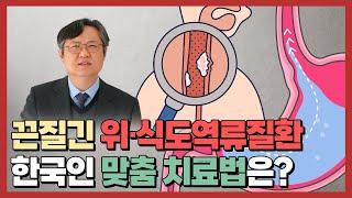 역류성식도염 치료, 꼭 약을 장기간 복용해야 하나요?