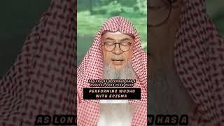 Performing Wudhu With Eczema #assimalhakeem #islam #muslim #wudhu #guidance #eczema #fatwa #pray
