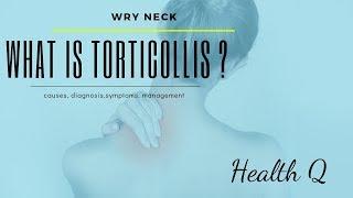 What is TORTICOLLIS ? WRY NECK (causes, diagnosis,symptoms, management)  PART 1