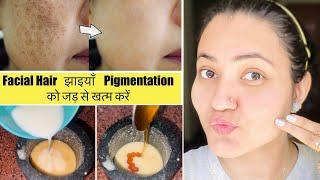 In 7 Days Remove झाइयाँ, Blemishes, Pigmentation, Facial Naturally & Get Clear Glowing Skin