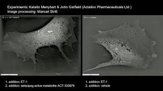 3D live cell time-lapse compilation