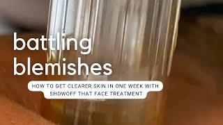 ReMove Blemishes in 1 Week