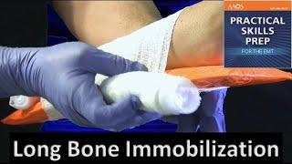 Long Bone Immobilization by David L Dalton