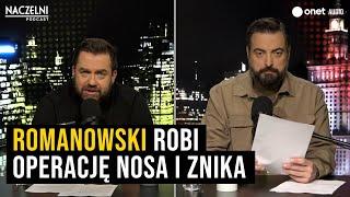 Romanowski robi operację nosa i znika | Naczelni