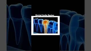 Dental Health Care| Dr. Wasif Rashid | #foryou #shorts