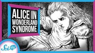 Alice in Wonderland Syndrome