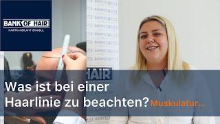 Haartransplantation - Was gibt es bei der Haarlinie zu beachten?