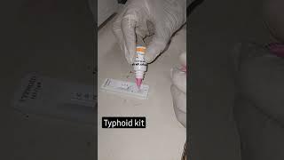 Typhi dot  [IgG & IgM] test procedure 