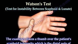 Examination Of The Hand, Tests - Everything You Need To Know - Dr. Nabil Ebraheim