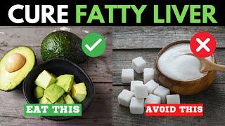 12 Best Foods To Cure Fatty Liver Fast