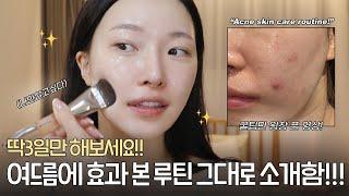 cc) It worked on hard acne! I'm telling all the nighttime skincare routine secretsㅣArang