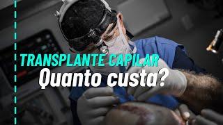 Quanto custa um transplante capilar?