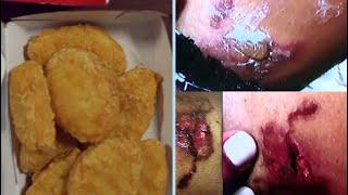 McDonald's found liable for hot Chicken McNugget that burned girl