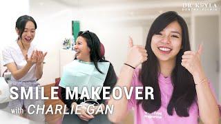 Porcelain Veneers AND Bone Screws? Charlie’s Smile Makeover Journey! | Dr Kayla Dental Clinic