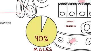 Neisseria gonorrhea (STI) symptoms, pathophysiology, complications and treatment