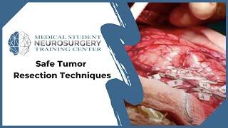 Safe Tumor Resection Techniques