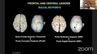 Frontal Lobe anatomy and Approaches to the Ventricles