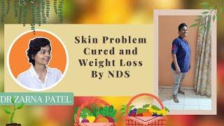 Skin Problem Healed & Weight Loss By Dr. Zarna Patel (NDS) [Patients Experience] | New Diet System