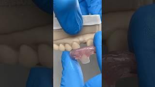 Lateral Nesbit @EnvisiontecMain #envisiontec #dental #teeth #smile #lsk121shorts #shortvideo
