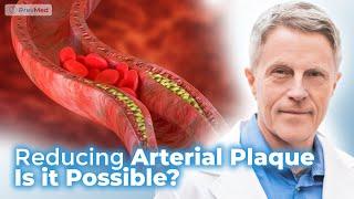 Reducing Arterial Plaque - Is it Possible?