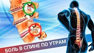 ТЯЖЕЛО УТРОМ ВСТАТЬ || БОЛИТ СПИНА