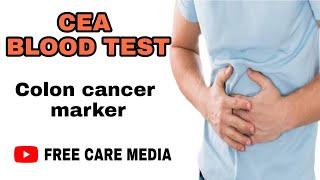 CEA blood test in malayalam | colon cancer marker