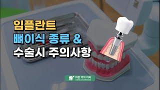 임플란트 뼈이식 종류 및 수술시 주의사항 평택치과 소사벌 바른이턱치과