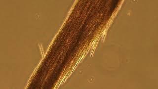 Aphanizomenon flos-aquae | Wikipedia audio article