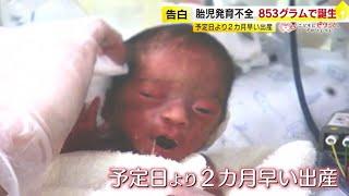 わずか853gで生まれ…「とにかく生き延びて欲しい」　早産などで小さく生まれた赤ちゃんたちの“同窓会”　悩みや不安を共有 【こどもにピタッとプロジェクト62】　／　（2024/11/07  OA）