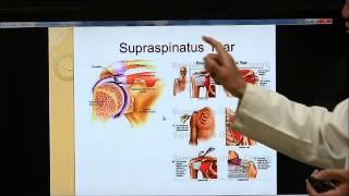 HOLISTIC HEALING | HOW TO TREAT SHOULDER PAIN NATURALLY