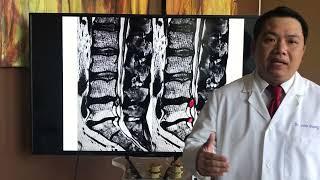 Dr. John Duong - Lower Back Pain