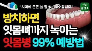잇몸뼈까지 녹게만드는 잇몸병! 이렇게만 하세요 평생 치과에 큰돈 쓸 일 없어집니다. 잇몸병을 99% 예방하는 칫솔질 방법, 잇몸에 좋은 음식!