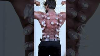 #drycupping #musclebuilding #motivation #motivational #muscle #chennai #bangalore #bengaluru #viral