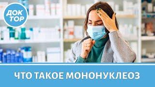 Инфекционный мононуклеоз: симптомы, лечение, восстановление