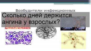 Сколько дней держится ангина у взрослых?