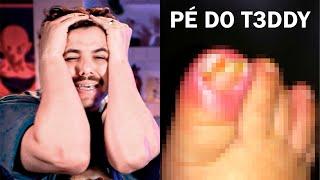 T3DDY sofre AS PIORES DORES DO MUNDO