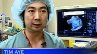 St. Mary's Doctors show what 3-D echocardiagram means to their surgeries