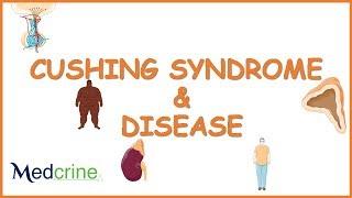 Cushing Syndrome :  causes, pathophysiology, symptoms and treatment