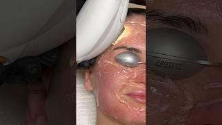 ASMR Laser Treatment